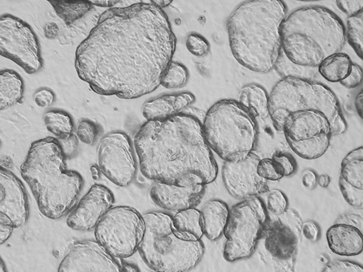organoids